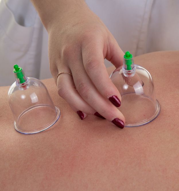 Dry Cupping