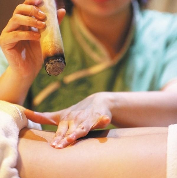 Moxa Cupping