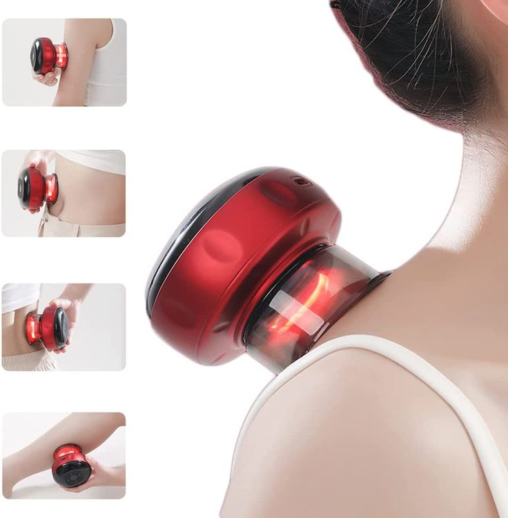 electric cupping